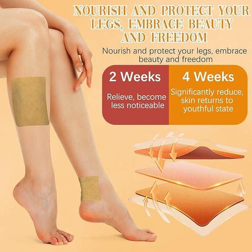 Instant Relief Varicose Vein Patches (Buy 1 get 1 Free🔥)
