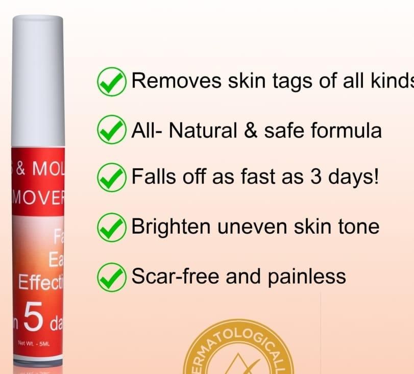 Tags & Mole Remover (Buy 1 Get 1 Free)