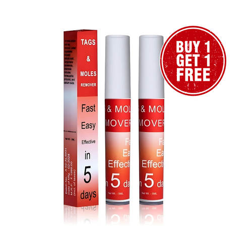 Tags & Mole Remover (Buy 1 Get 1 Free)